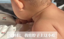 六个月宝宝胡萝卜过敏怎么办？