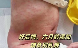 6个月宝宝吃米糊过敏