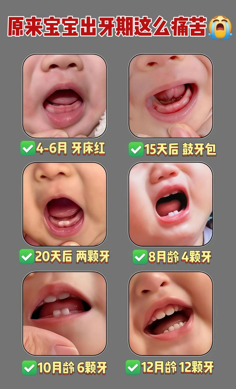 3月龄宝宝能吃磨牙棒吗？安全吗？-图3