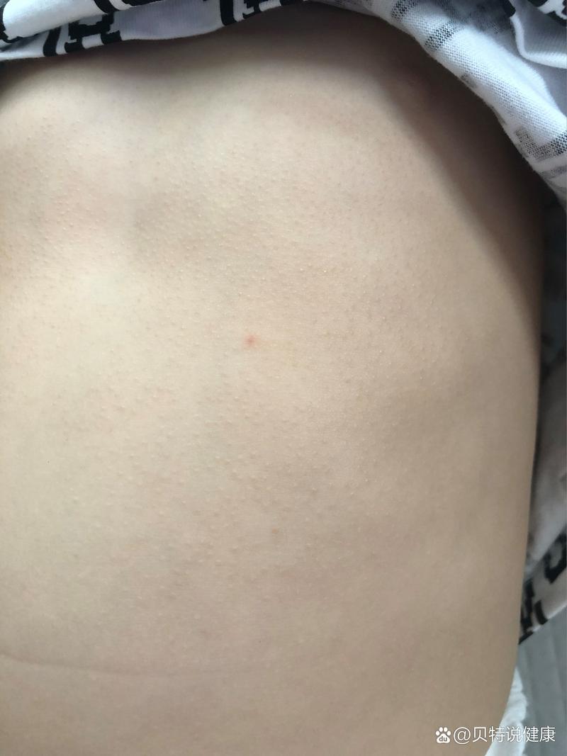 宝宝吃了虾皮起了疙瘩-图3 宝宝吃了虾皮起了疙瘩-图3