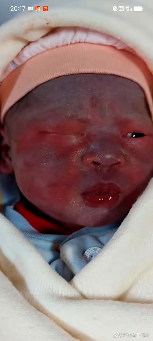 宝宝吃完带鱼脸上发红-图1 宝宝吃完带鱼脸上发红-图1