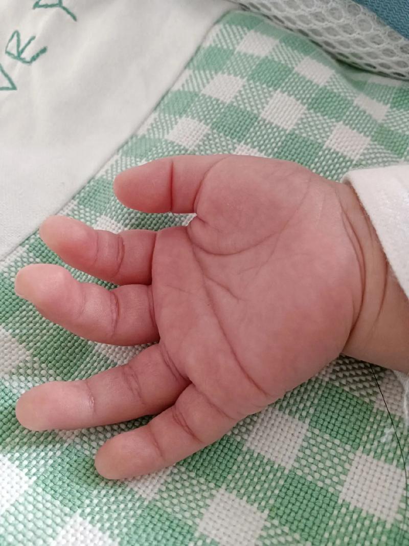 10个月宝宝怎么吃小抄手？-图3