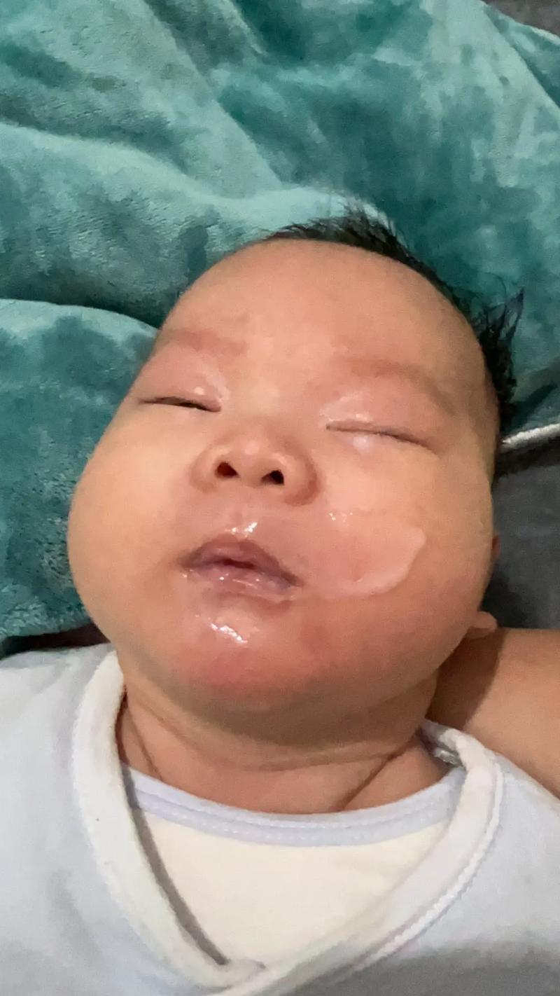 宝宝吃猪油馍呕吐是过敏还是不消化？-图3