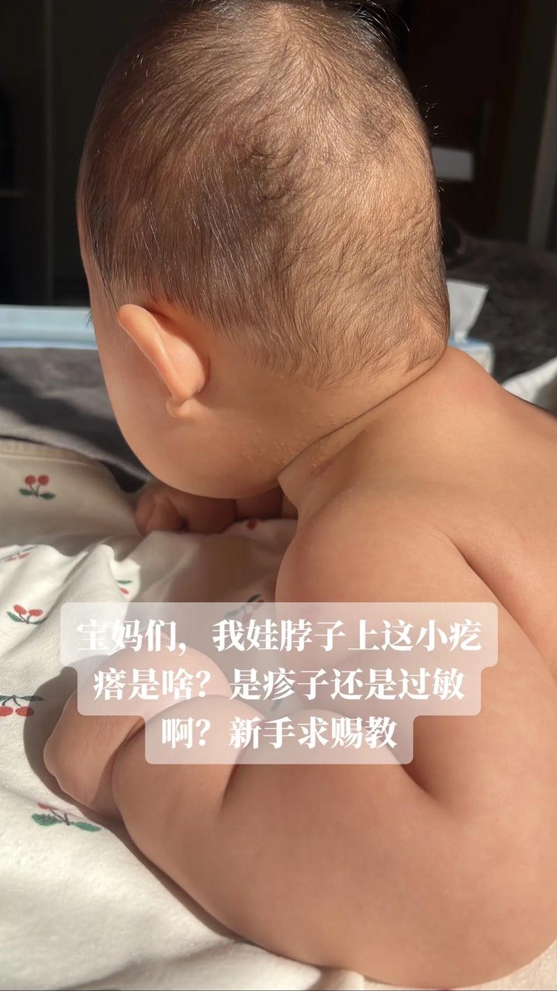 六个月宝宝胡萝卜过敏怎么办？-图1