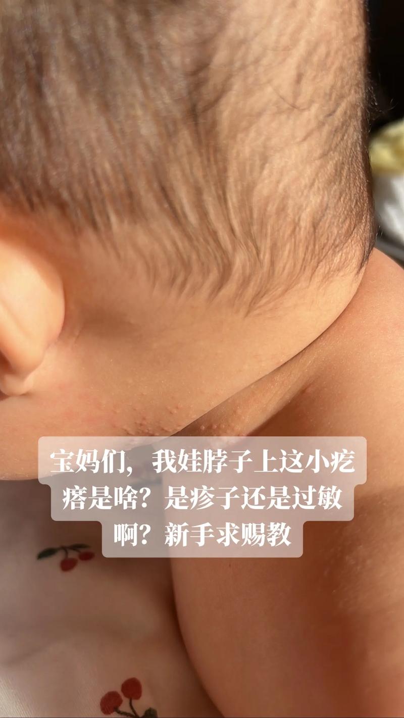 六个月宝宝胡萝卜过敏怎么办？-图2