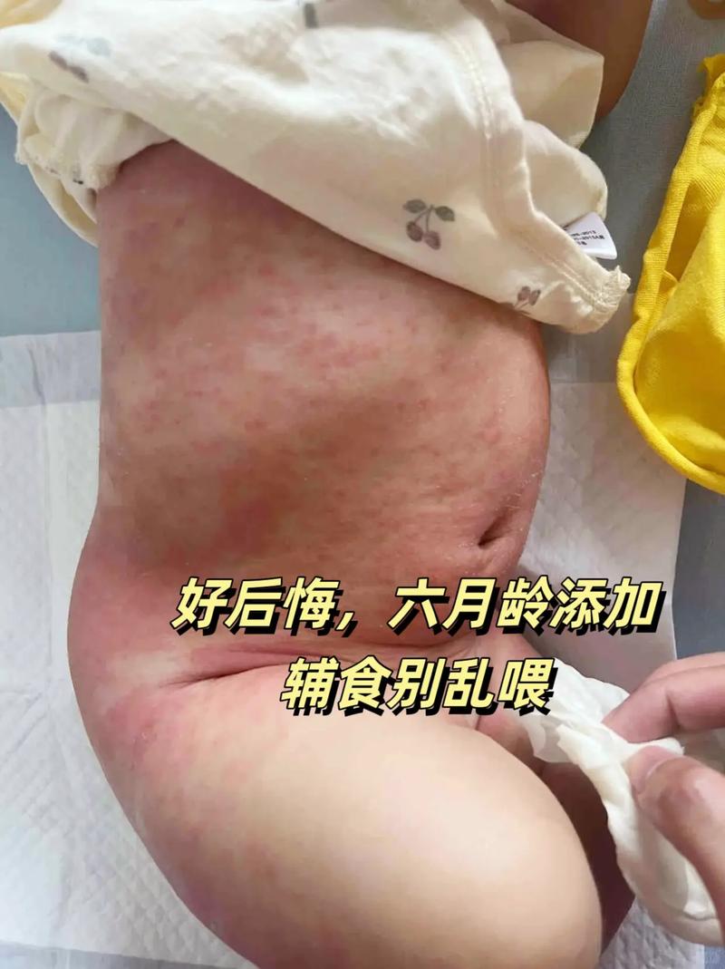 6个月宝宝吃米糊过敏-图1