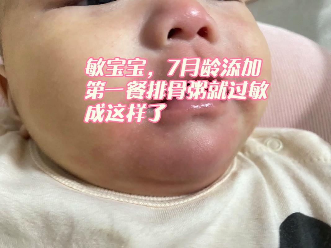 6个月宝宝吃米糊过敏-图3