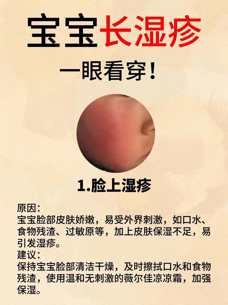 宝宝湿疹能吃猪肉吗？-图3