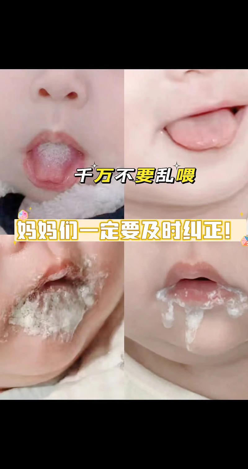 宝宝吃土豆泥后吐，是过敏还是消化不良？-图2