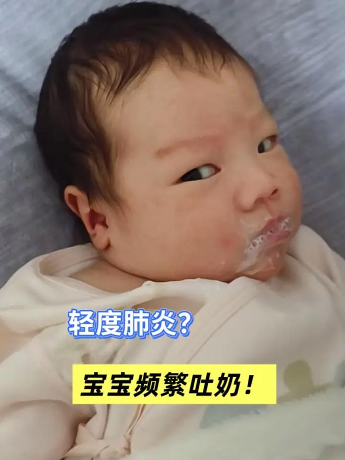 宝宝吃土豆泥后吐，是过敏还是消化不良？-图3